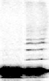 a protein gel